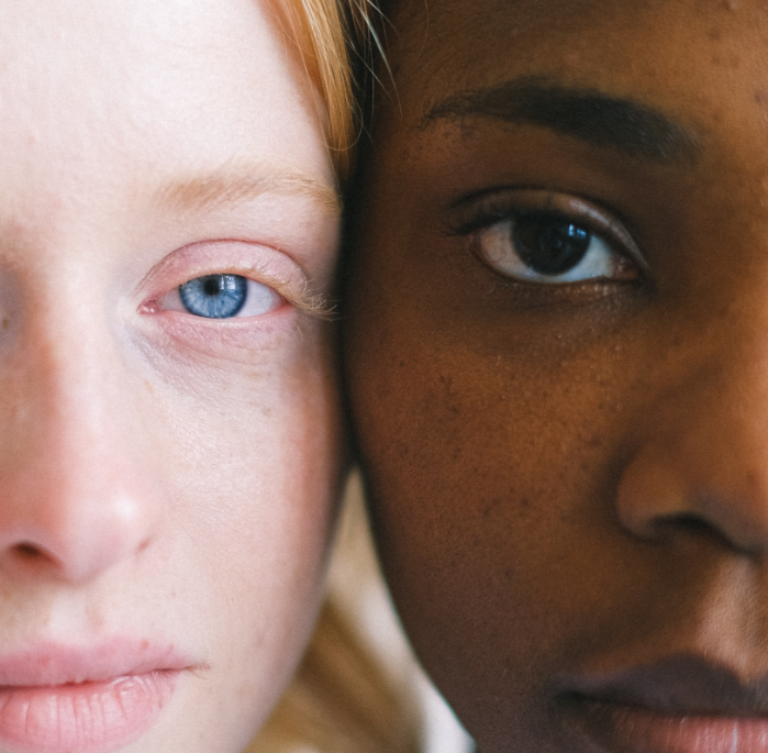 What Makes Dark Circles Worse