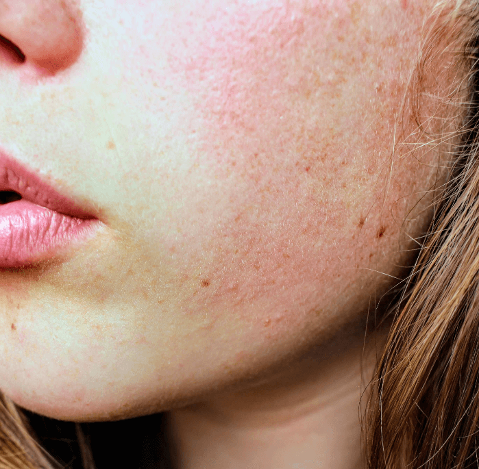 Top 3 Natural Body Oils for Dry Skin