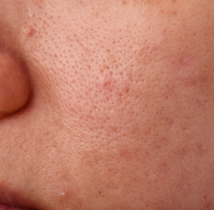 Probiotic Toner