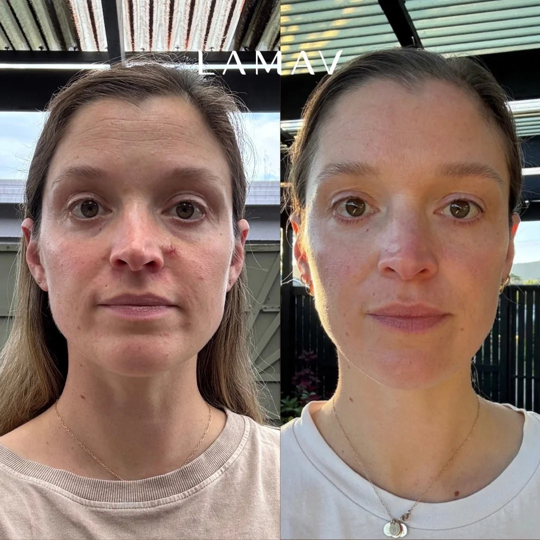 Before and after using LAMAV Age-Defence Organic Skincare Essentials, showing smoother, more even-looking skin