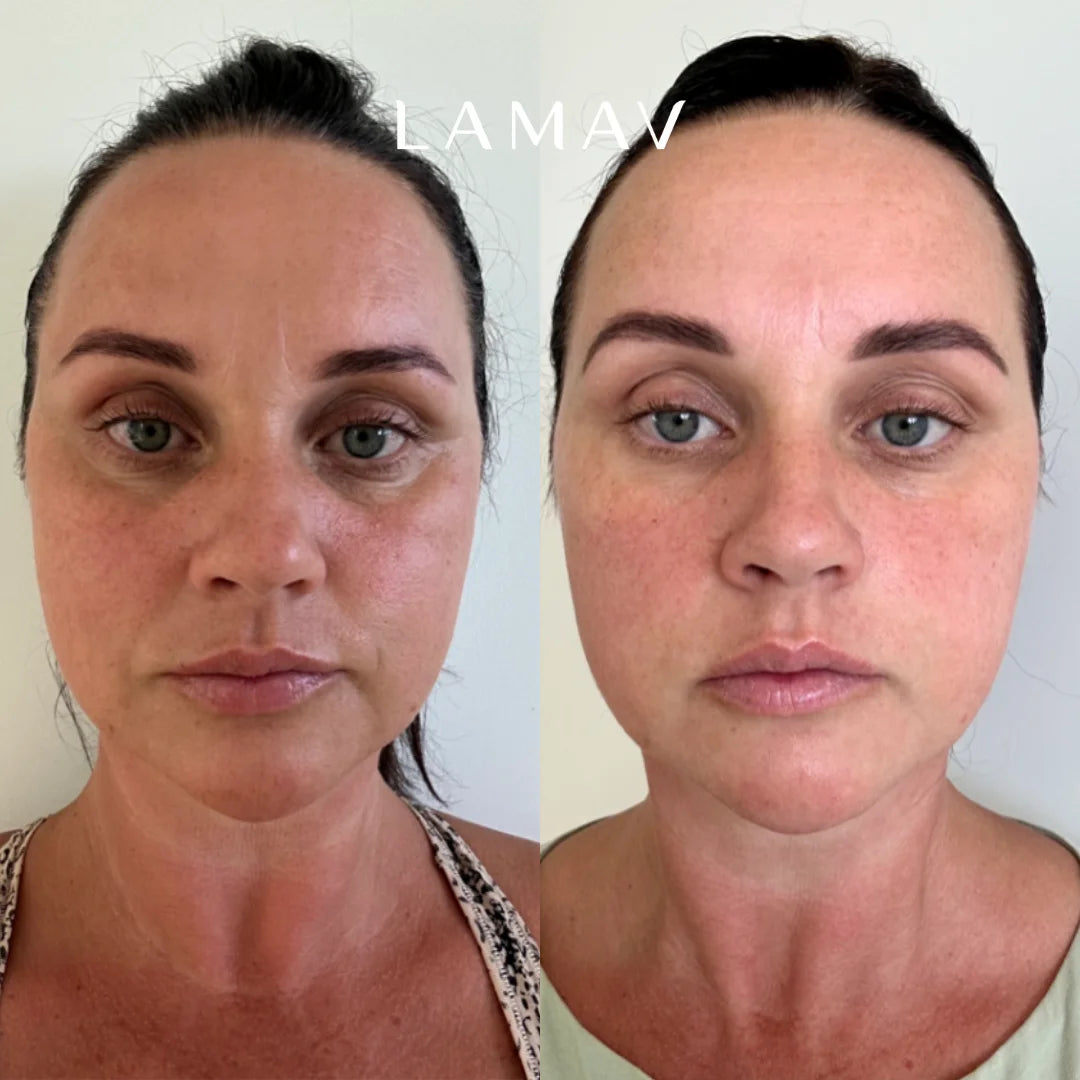 After using LAMAV Age-Defence Complete Skincare Collection for dry, sensitive skin, showing a refreshed, radiant look