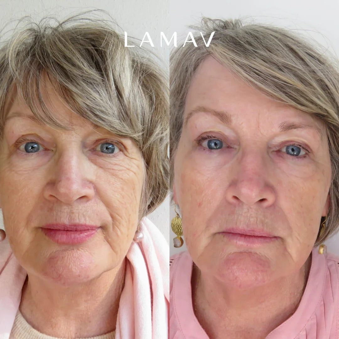 Before and after using LAMAV Age-Defence Complete Skincare Collection on dry, sensitive skin, with a more hydrated look
