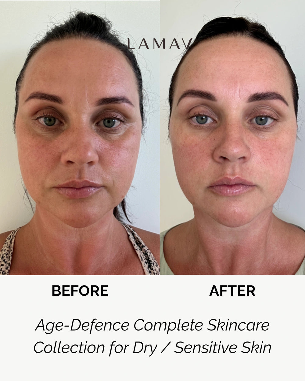 Age Defence Complete Skincare Collection by LAMAV — seven anti-aging skincare bottles on a stone podium, front view | firming routine