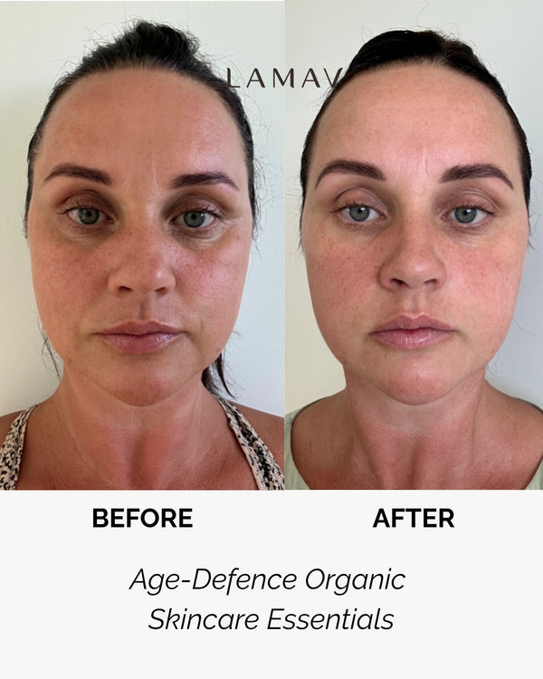 Age Defence Skincare Essentials by LAMAV — woman's before and after face comparison | Smooths and firms the complexion