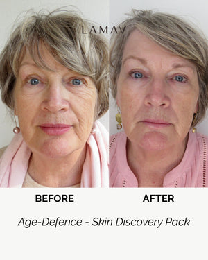 Age Defence Skin Discovery Pack by LAMAV — mature woman's before and after face comparison | Visibly smooths wrinkles