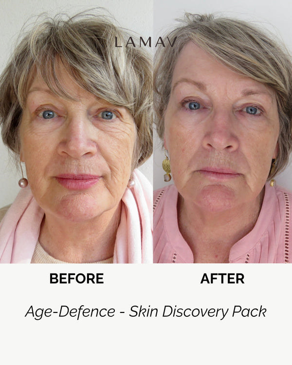 Age Defence Skin Discovery Pack by LAMAV — mature woman's before and after face comparison | Visibly smooths wrinkles
