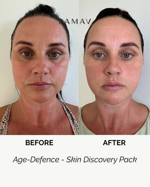 Age Defence Skin Discovery Pack by LAMAV — woman's before and after face comparison | Brightens and evens skin tone