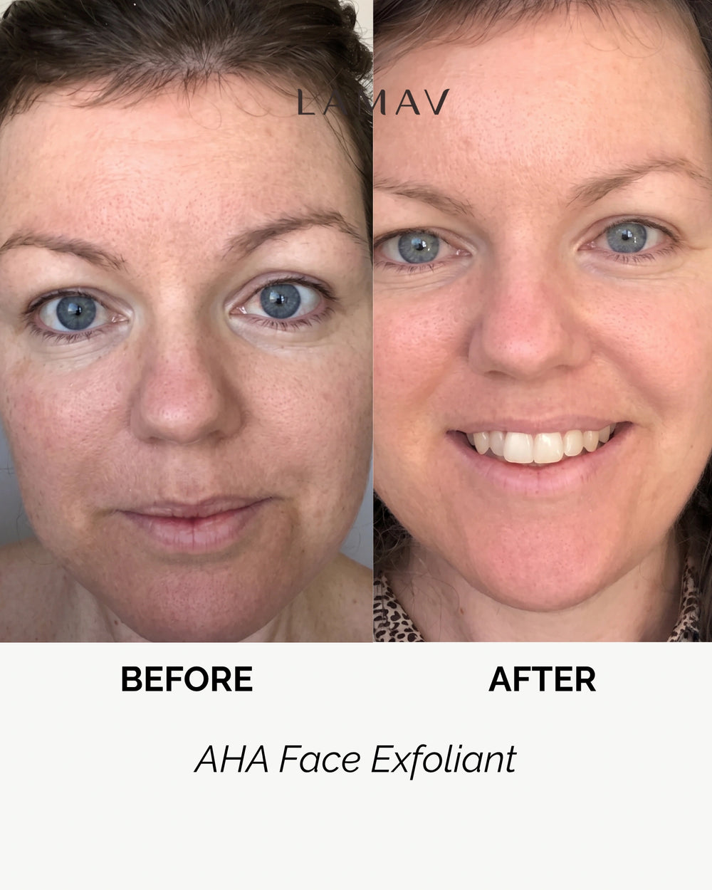 AHA Face Exfoliant by LAMAV — 60ml light green squeeze tube, front view | Gently purifies and clarifies skin