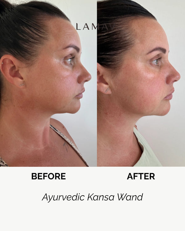 Ayurvedic Kansa Wand by LAMAV — woman's before and after side profile comparison | Visibly lifts and firms skin