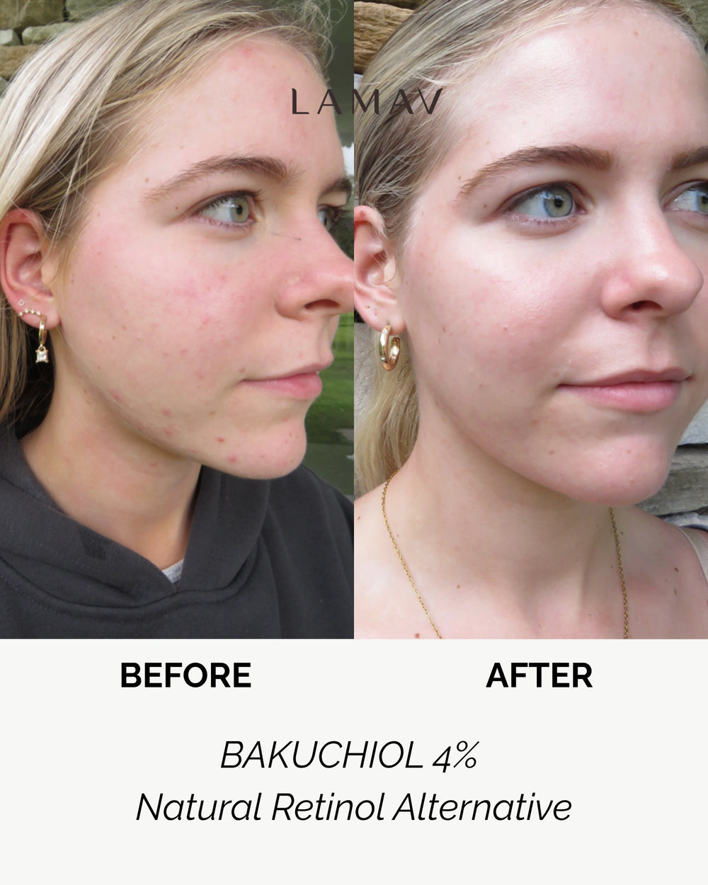 Bakuchiol 4% Booster by LAMAV — white dropper bottle with three beauty award badges | natural retinol alternative