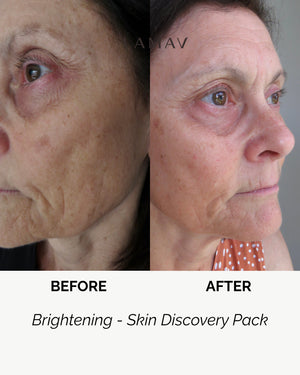 Brightening Discovery Pack by LAMAV — before and after split screen of an older woman's face | evens skin tone