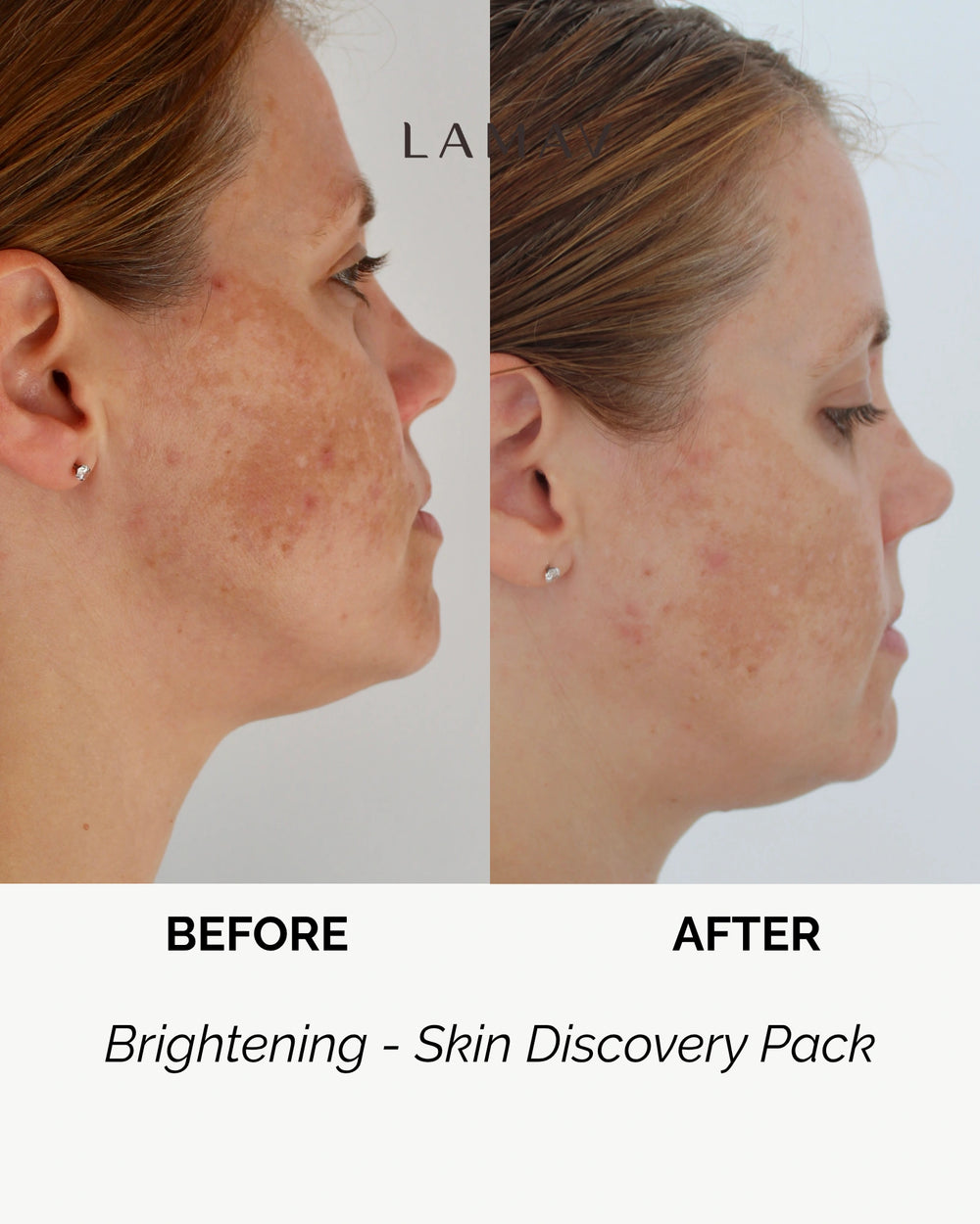 Brightening Discovery Pack by LAMAV — closed box and four products on a wavy white stone | visibly reduces dark spots.