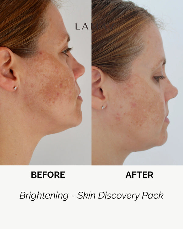 Brightening Discovery Pack by LAMAV — before and after side profile of a woman's face | fades dark spots