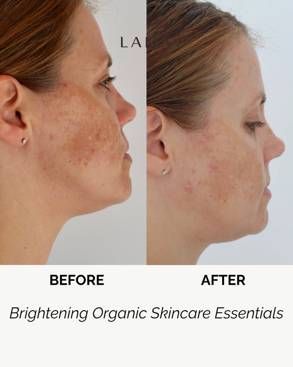 Brightening Essentials by LAMAV — before and after side profile of a woman's face | reduces pigmentation and redness