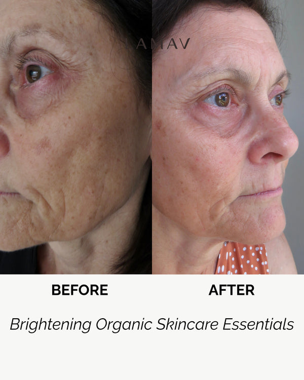 Brightening Essentials by LAMAV — before and after split screen of an older woman's face | fades dark spots