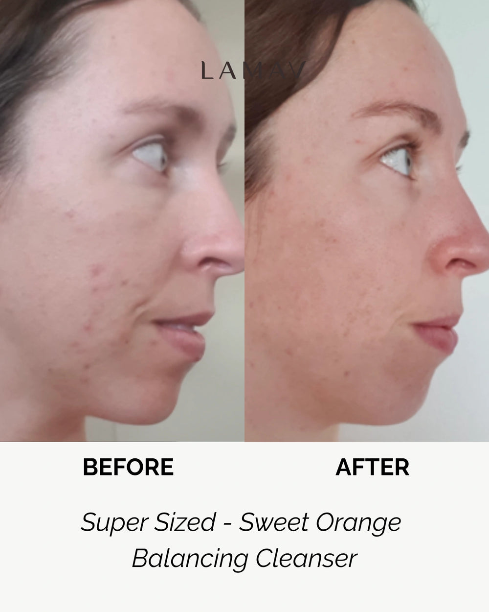 Super Sized Sweet Orange Balancing Cleanser by LAMAV — bottle next to industry awards | award-winning organic care